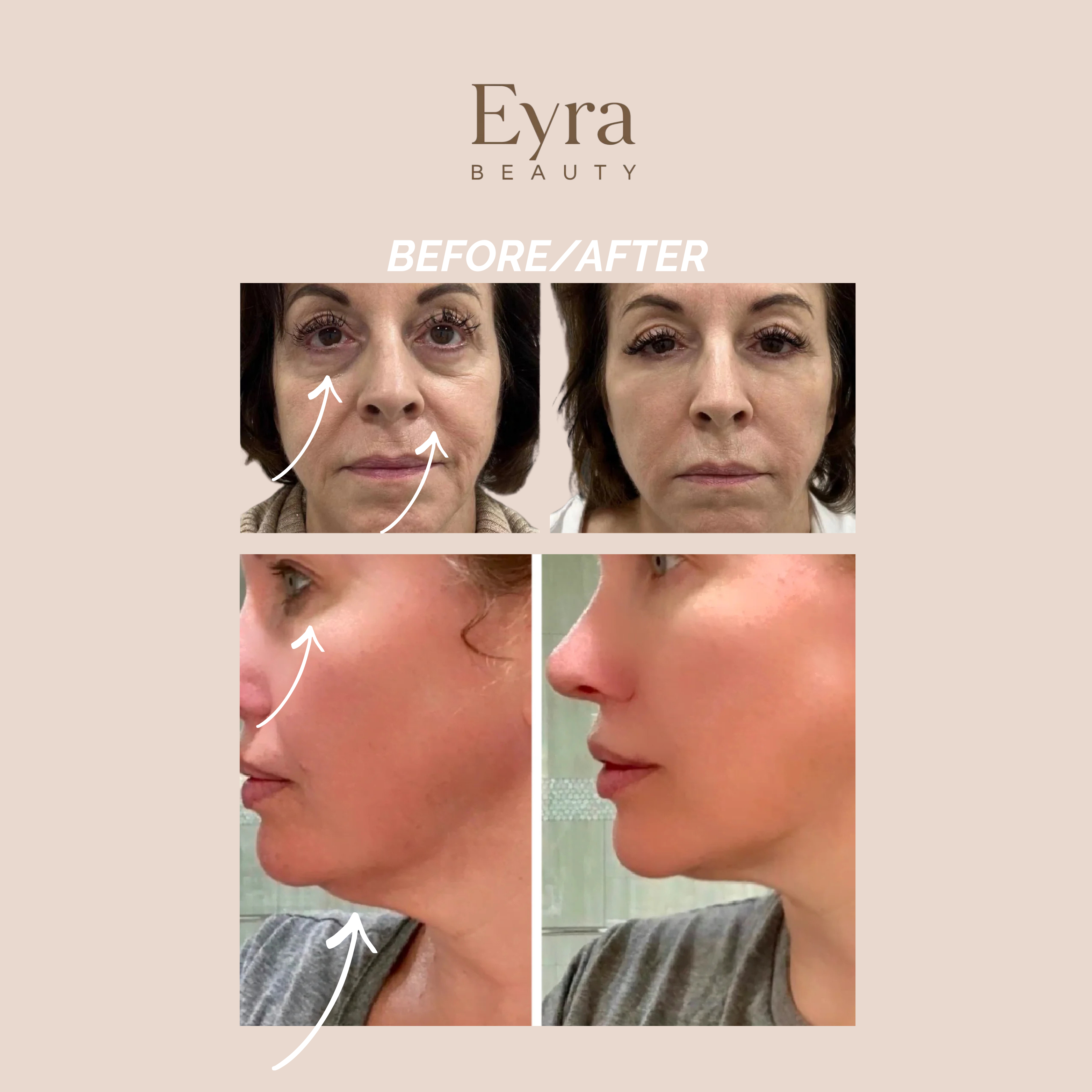 The Eyra Skin Flow Brush
